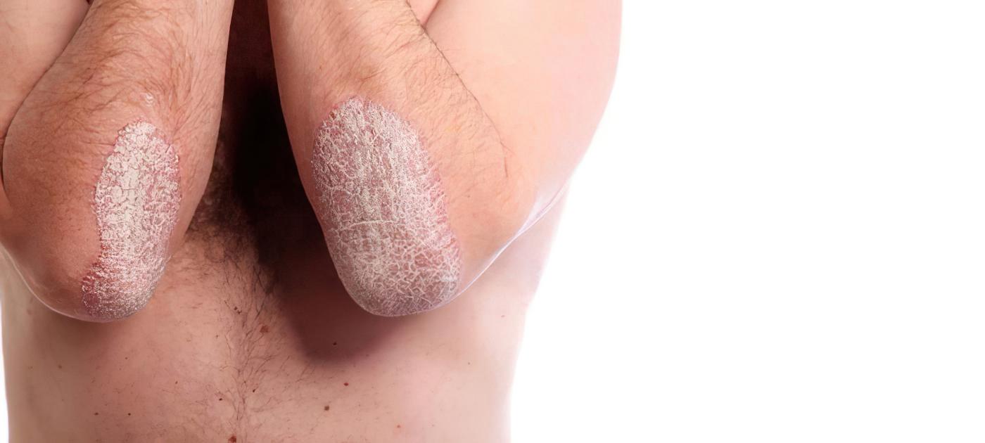 Διεθνής Επικαιρότητα: Ντάνιελ Κρεγκ και Πολιτιστικές Παρά Traditions στην Ελλάδα